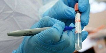 Hasta la fecha en San Luis se han registrado  61.422 casos positivos de Coronavirus. Gentileza