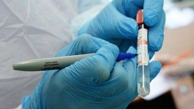Hasta la fecha en San Luis se han registrado  61.422 casos positivos de Coronavirus. Gentileza