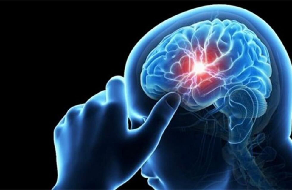 Jornada de prevención y tratamiento del Accidente Cerebro Vascular
