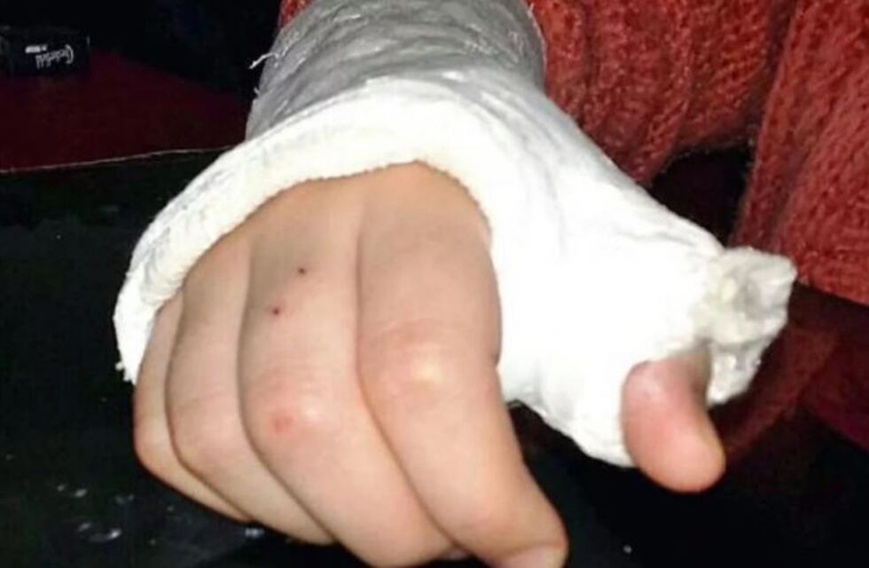 Bullying en Bahía Blanca: la obligaron a comer pasto y le quebraron cuatro dedos