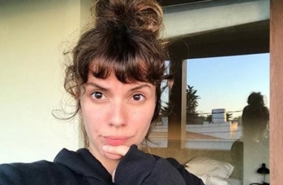 La impresionante foto de Gimena Accardi después de tomar sol