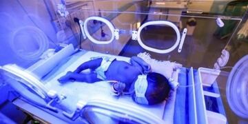 Eliska, la niña que nació de su madre muerta (Web)