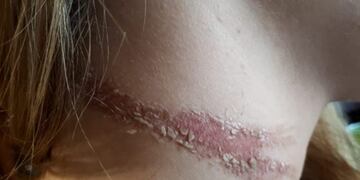 motochorro pergamino