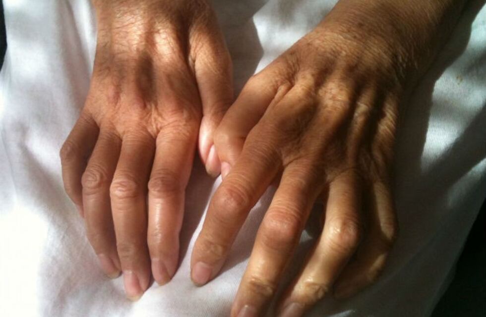 ELA: imágenes 3D del interior de neuronas, una ayuda clave