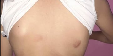 La madre hizo públicas las fotos que tomó a una de las nenas este jueves\u002E