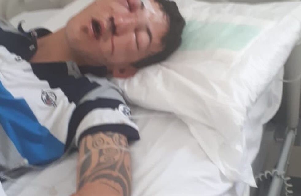 Tandil: brutalmente golpeado por dos policías por defender a una chica