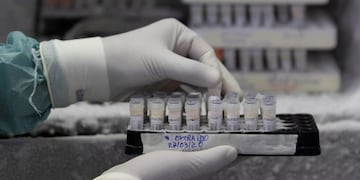 -FOTODELDIA- AME8423\u002E BRASILIA (BRASIL), 27/03/2020\u002E- Detalle del congelador con 1500 pruebas covid-19 almacenadas a menos 73 grados, del Laboratorio Central de Salud Pública de Brasilia, este viernes\u002E El laboratorio en la capital brasileña comenzará a trabajar 24 horas por día a partir del lunes para disminuir el tiempo de divulgación de los exámenes de pacientes con sospecha de coronavirus\u002E EFE/ Joédson Alves