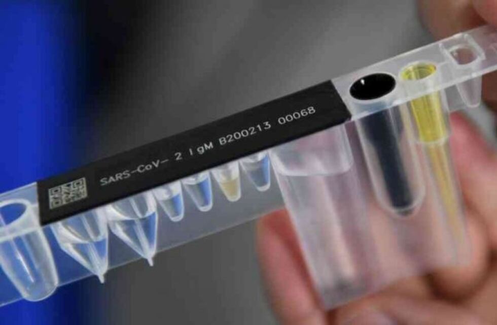 Mendoza no registró nuevos casos positivos de coronavirus