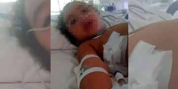 Una niña de 4 años herida gravemente de una bala perdida en barrio San Alberto\u002E (El Doce TV)
