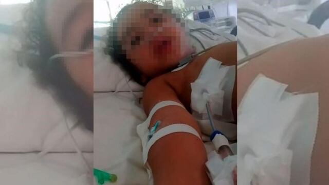 Una niña de 4 años herida gravemente de una bala perdida en barrio San Alberto\u002E (El Doce TV)