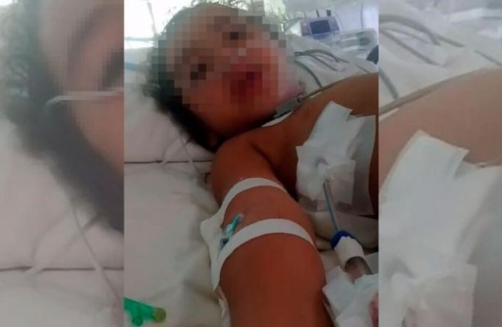 Una nena de 4 años fue herida por una bala perdida que le perforó el pulmón y el hígado