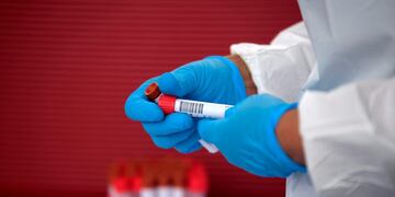 A healthcare worker organizes Covid-19 tests that were just administered at United Memorial Medical Center Covid-19 testing site in Houston, Texas Thursday, June 25, 2020\u002E - The United States on June 25 battled a resurgence of coronavirus cases in a number of states including Texas, while the World Health Organization warned that several European countries were also facing dangerous upticks\u002E (Photo by Mark Felix / AFP)
