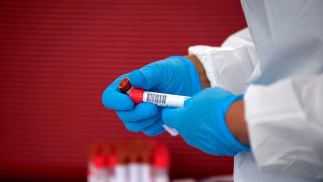 A healthcare worker organizes Covid-19 tests that were just administered at United Memorial Medical Center Covid-19 testing site in Houston, Texas Thursday, June 25, 2020\u002E - The United States on June 25 battled a resurgence of coronavirus cases in a number of states including Texas, while the World Health Organization warned that several European countries were also facing dangerous upticks\u002E (Photo by Mark Felix / AFP)