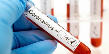 Coronavirus test\u002E