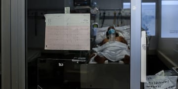 -FOTOGALERÍA- ACOMPAÑA CRÓNICA: CORONAVIRUS ARGENTINA - AME3295\u002E BUENOS AIRES (ARGENTINA), 08/09/2020\u002E- Fotografía de un paciente COVID-19 en la unidad de Terapia Intensiva, el 6 de septiembre de 2020, en un hospital de la Provincia de Buenos Aires (Argentina)\u002E ra hacer frente a la pandemia, pero médicos y enfermeros están ya al borde del colapso por el estrés, el agotamiento y la amenaza de contagio\u002E EFE/ Juan Ignacio Roncoroni   casos del dia