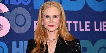 La impactante revelación de Nicole Kidman: "Dejé el botox y volví a sonreír"