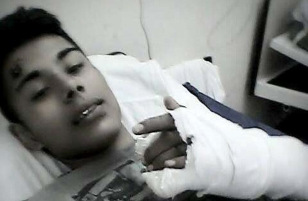 Organizan evento solidario para colaborar con un joven al que debieron amputarle una pierna