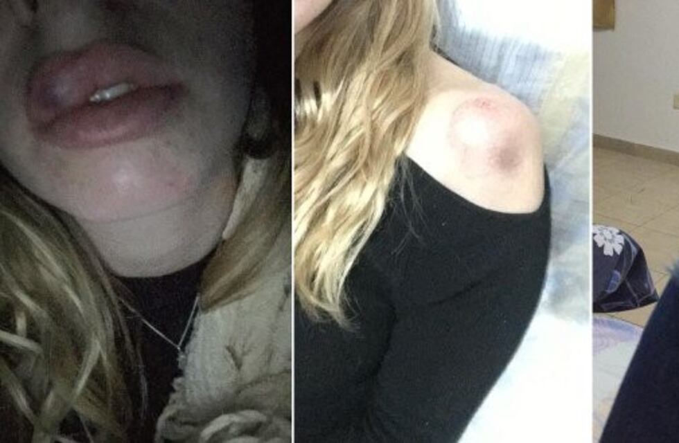 El insólito descargo del joven acusado de agredir a una chica en un McDonald's