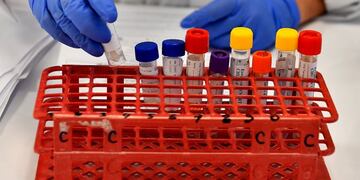 Test de Coronavirus\u002E