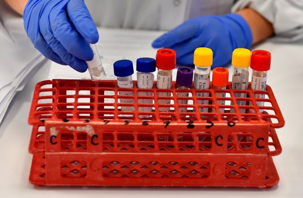 Coronavirus: una nuevo contagio en Córdoba este martes