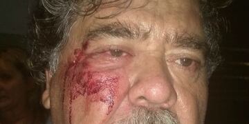 Villa Corina, trompadas, agresiones y escándalo\u002E