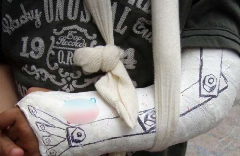 Se cayó del techo mientras arreglaba el cable para ver el partido de Argentina