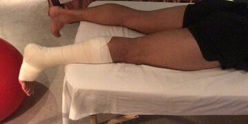 Optimismo en la Selección por la recuperación de Facundo Campazzo