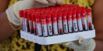 Colombo (Sri Lanka), 04/09/2020\u002E- A Sri Lankan health worker packs blood samples collected from the migrant workers for COVID-19 tests in Colombo, Sri Lanka, 04 September 2020\u002E The Sri Lankan government has lifted the majority of coronavirus restrictions, which were implemented nearly four months ago, and is preparing for a full reopening of businesses and activities in an effort to avoid an economic slump\u002E (Abierto) EFE/EPA/CHAMILA KARUNARATHNE