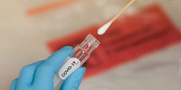 El hombre murió este martes por la mañana\u002E