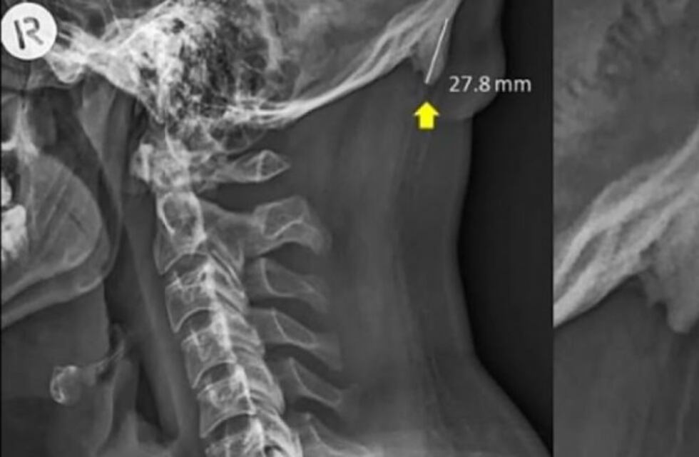 El uso del celular podría causar cambios en el esqueleto