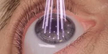 La operación oftalmológica con láser decía ser segura en su procedimiento, pero todo salió mal y la Justicia los condenó por dar información errónea\u002E