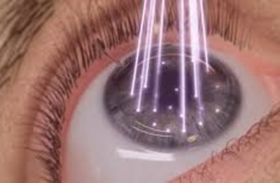 Ratifican la condena a una clínica oftalmológica por brindar información errónea en un folleto