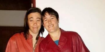 Síndrome de Dandy Walker