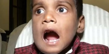 El joven hindú de 526 dientes (Foto: web)\u002E