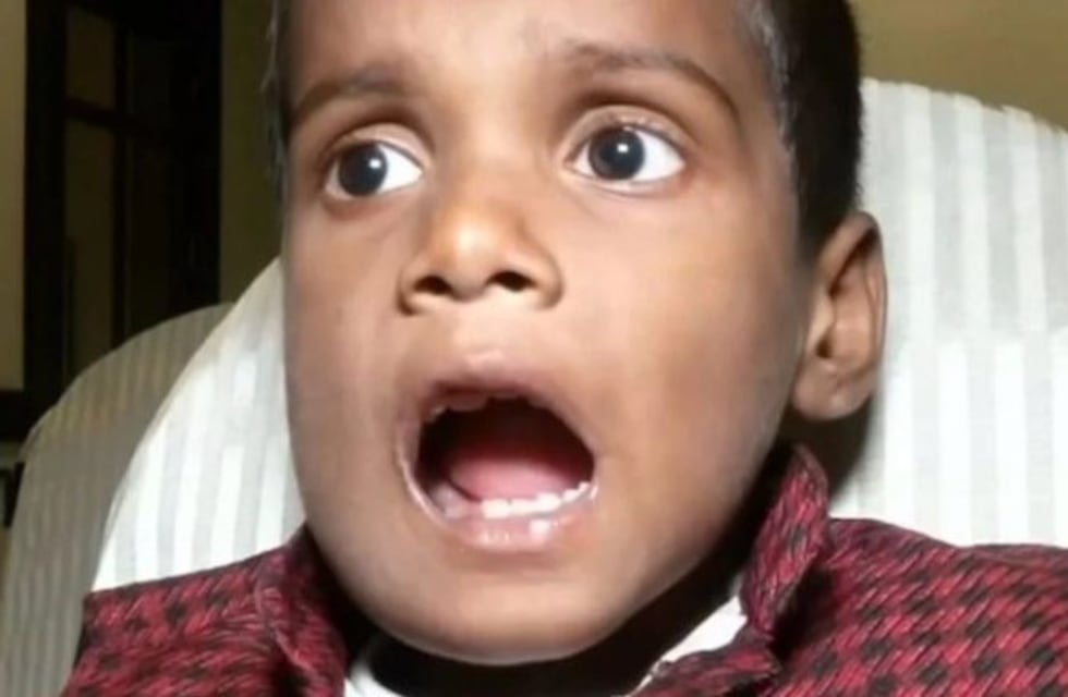 Le extrajeron 526 dientes a un niño indio de siete años