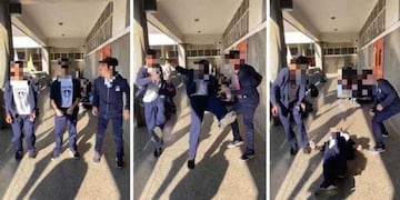 Un menor resultó con fracturas al participar del peligroso juego viral \