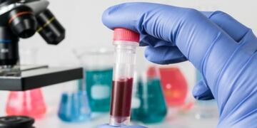 Actualizaron la definición de caso sospechoso de coronavirus\u002E (Web)\u002E