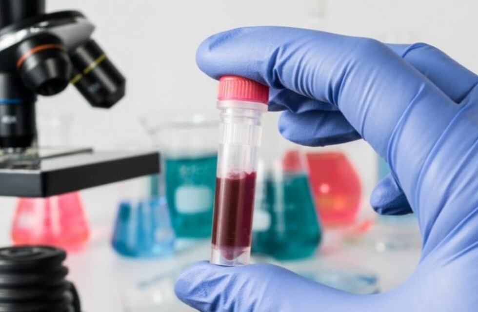 Actualizaron la definición de caso sospechoso de coronavirus