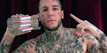 Alex Caniggia se operó la nariz