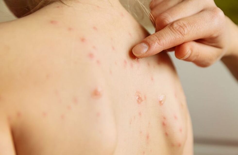 Jorge Rial y Horacio Cabak se pronunciaron en las redes contra los antivacunas