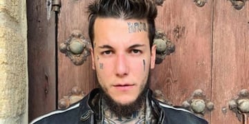 Alex Caniggia se borró los tatuajes de la cara y mostró el resultado: “Es de barat”