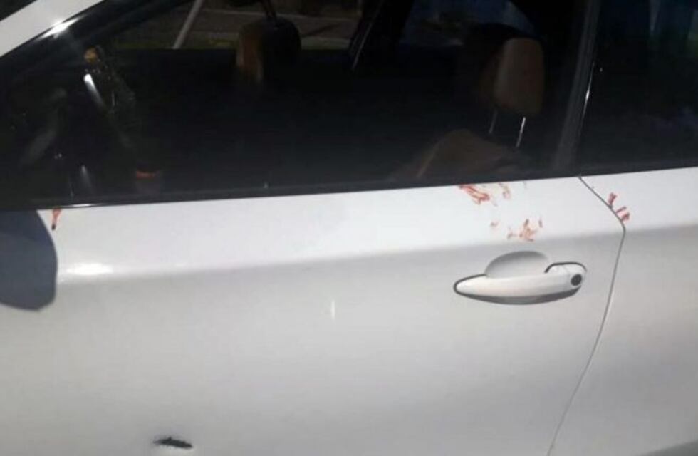Hieren a un sindicalista y a su hijo adolescente al atacar a balazos su auto