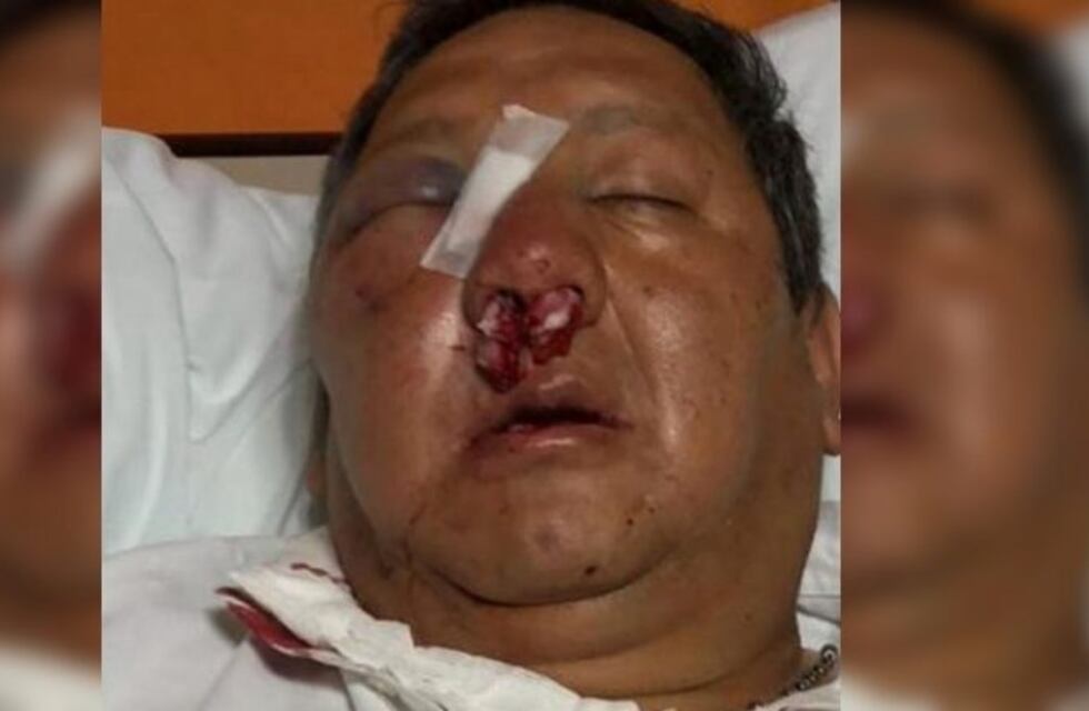 Un vendedor ambulante atacó brutalmente a un inspector de tránsito