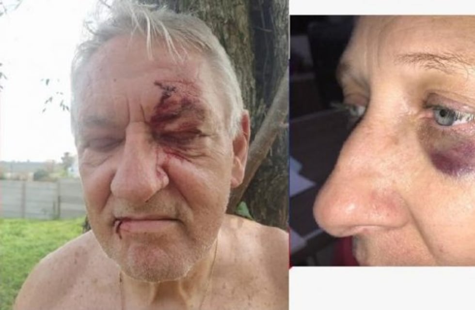 La justicia intervendrá en la causa por la agresión que sufrió el exintendente Meili