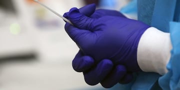 NEW YORK, NEW YORK - AUGUST 27: A medical worker shows the process for rapid coronavirus testing on the new Abbott ID Now machine at a ProHEALTH center in Brooklyn on August 27, 2020 in New York City\u002E The portable Abbott ID Now uses a nasal swab to detect acute and infectious cases of COVID-19\u002E ProHEALTH is offering the new service, which can deliver a test result in a s little as 15 minutes, at its centers in the tri-state area\u002E   Spencer Platt/Getty Images/AFP\n== FOR NEWSPAPERS, INTERNET, TELCOS & TELEVISION USE ONLY ==