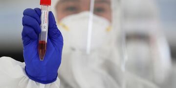 A health worker in a protective suit shows a Universal Transport Medium before they conduct a COVID-19 drive-through testing during a continuing enhanced community quarantine to prevent the spread of the new coronavirus in Taguig, Metro Manila, Philippines, Wednesday, April 29, 2020\u002E (AP Photo/Aaron Favila)