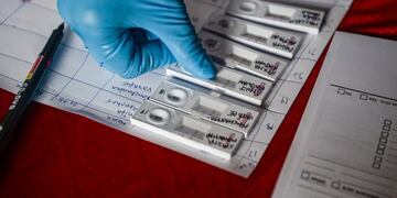 Coronavirus test\u002E