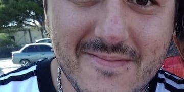 Policía golpeó a su pareja y le causó triple fractura nasal