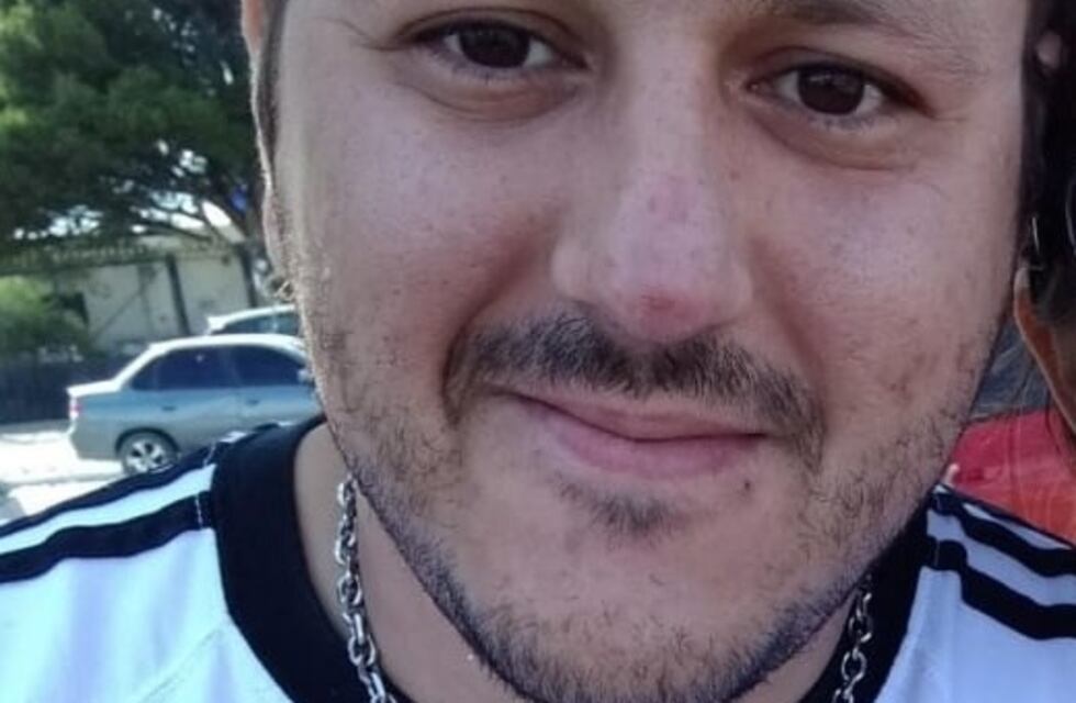 Policía golpeó a su pareja y le causó triple fractura nasal