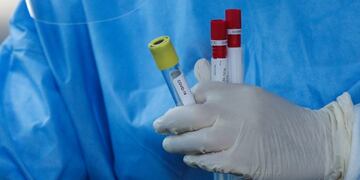 Rome (Italy), 18/08/2020\u002E- Health workers wearing overalls and protective masks perform swab tests at the San Giovanni hospital of the ASL Roma 1 health facilities in Rome, Italy, 18 August 2020\u002E (Italia, Roma) EFE/EPA/GIUSEPPE LAMI